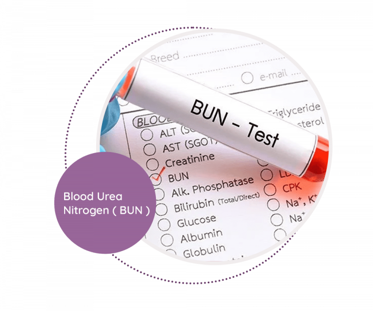 Blood Urea Nitrogen Bun Mediscan Lab