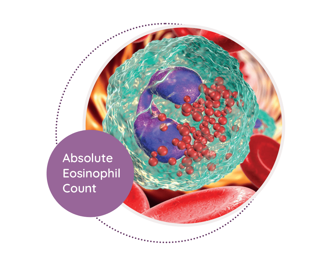 Absolute Eosinophil Count MediScan Lab