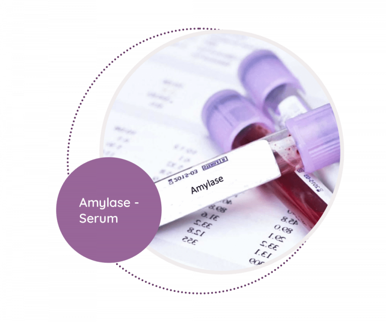 amylase-serum-mediscan-lab