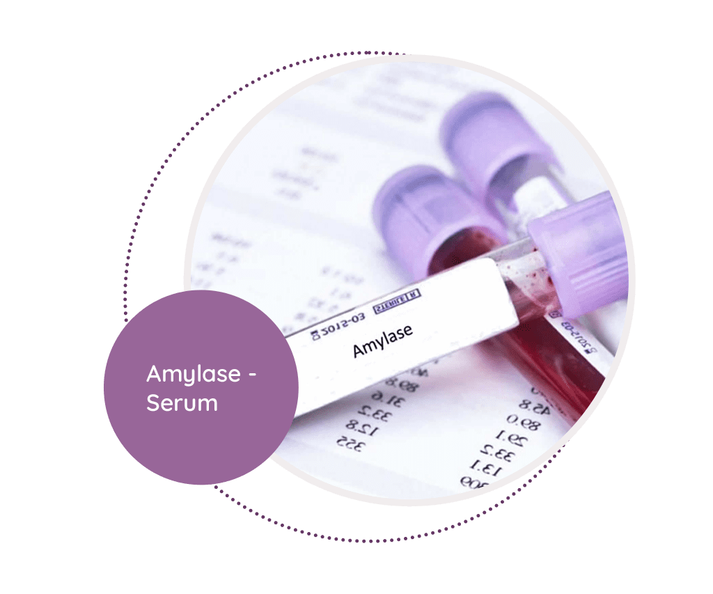 Amylase Serum MediScan Lab