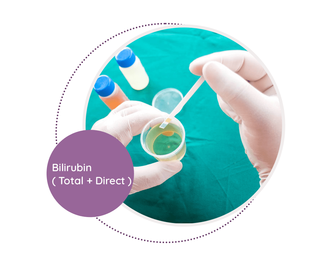 bilirubin-total-direct-mediscan-lab