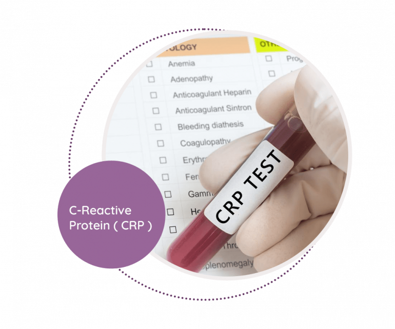 C-Reactive Protein (CRP) - MediScan Lab