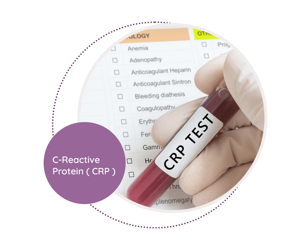 C Reactive Protein Crp Mediscan Lab 5507