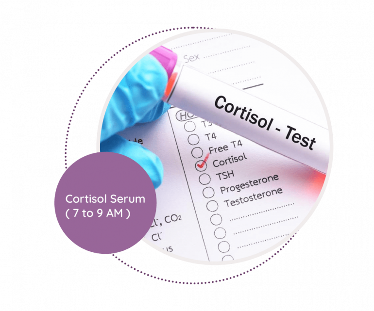 Serum Cortisol Assay at Edna Riley blog