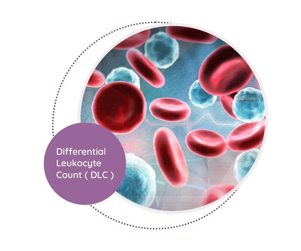 differential-leukocyte-count-mediscan-lab