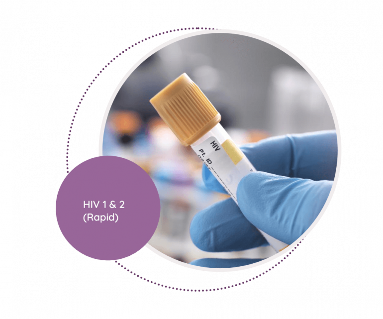 Hiv Rapid And Antibodies Mediscan Lab