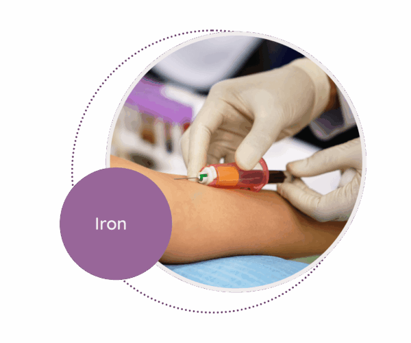 Iron - MediScan Lab
