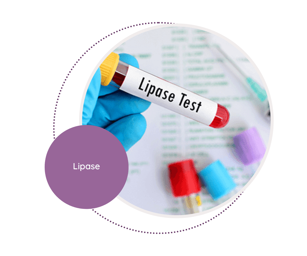 Lipase MediScan Lab