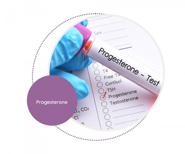 Progesterone MediScan Lab