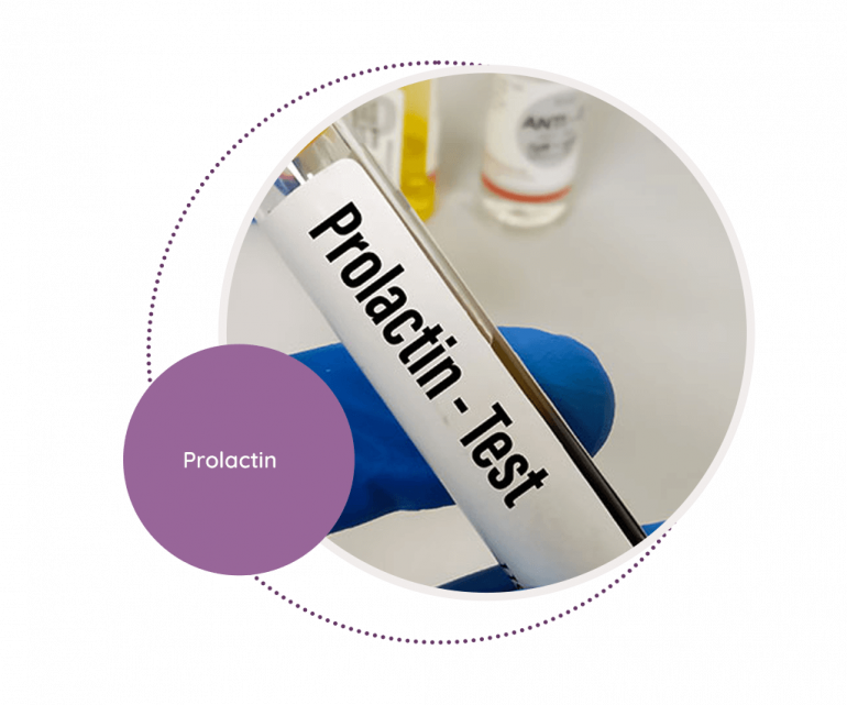 Prolactin - MediScan Lab