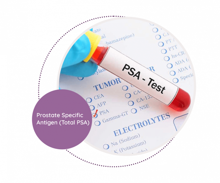 Prostate Specific Antigen (Total PSA) - MediScan Lab