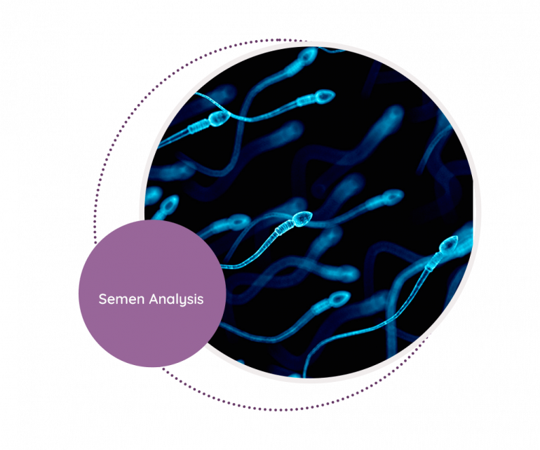 Semen Analysis - MediScan Lab