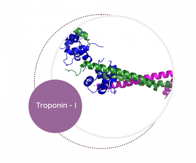 Troponin - I - MediScan Lab