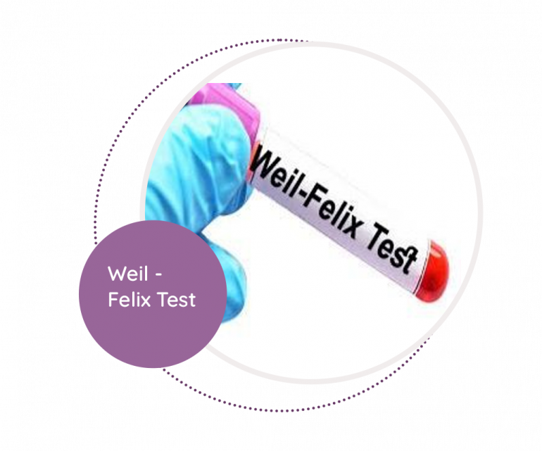 Weil Felix Test Mediscan Lab 8290